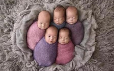 多胞胎世界纪录：最多的一胎有15个婴儿