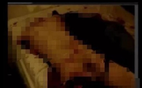 加拿大林俊事件15分钟视频内容：现场鲜血淋漓，尸体被肢解吃掉