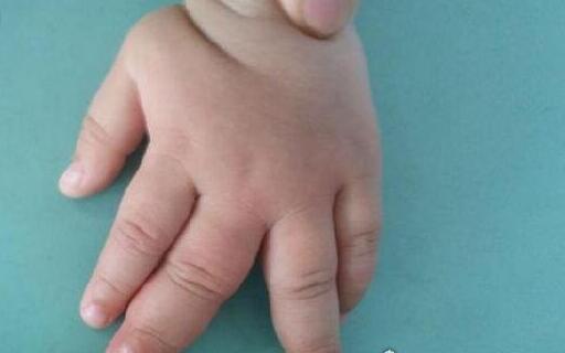 世界上最大的手指，他食指长达30厘米（整个手臂重20斤）