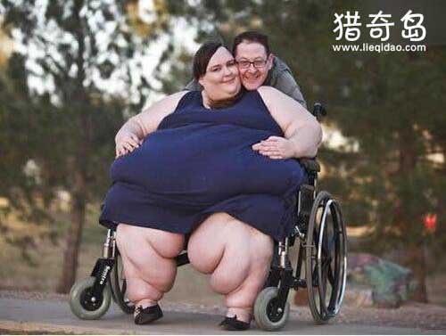 世界上最胖的女人，苏珊娜·埃曼重1450斤(期望体重有1吨)